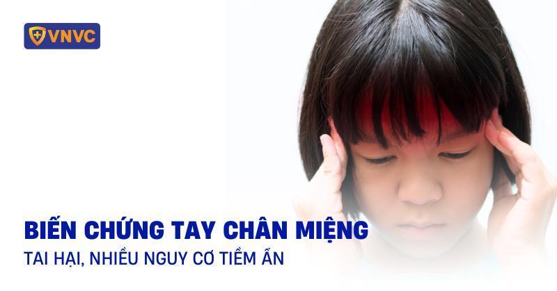 Các biến chứng nguy hiểm của bệnh chân tay miệng cần lưu ý